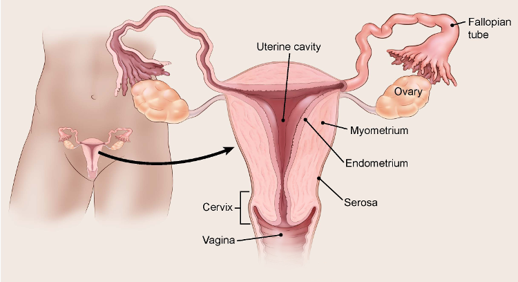 UTERUS CANCER