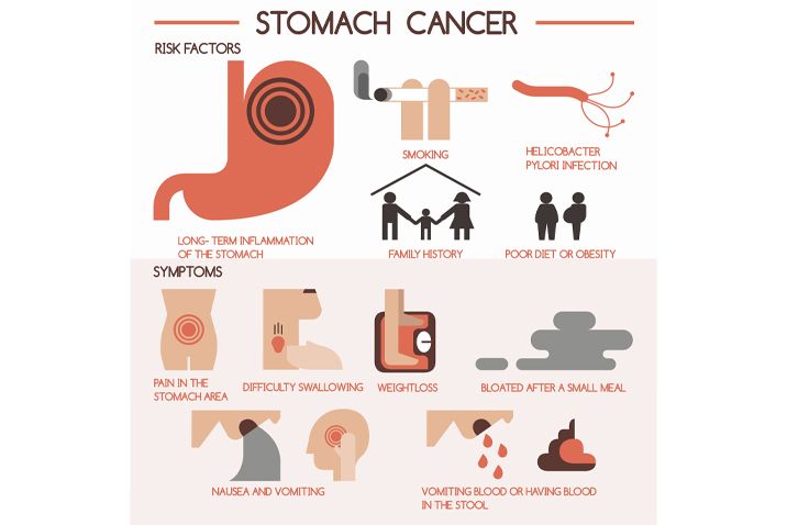 STOMACH CANCER