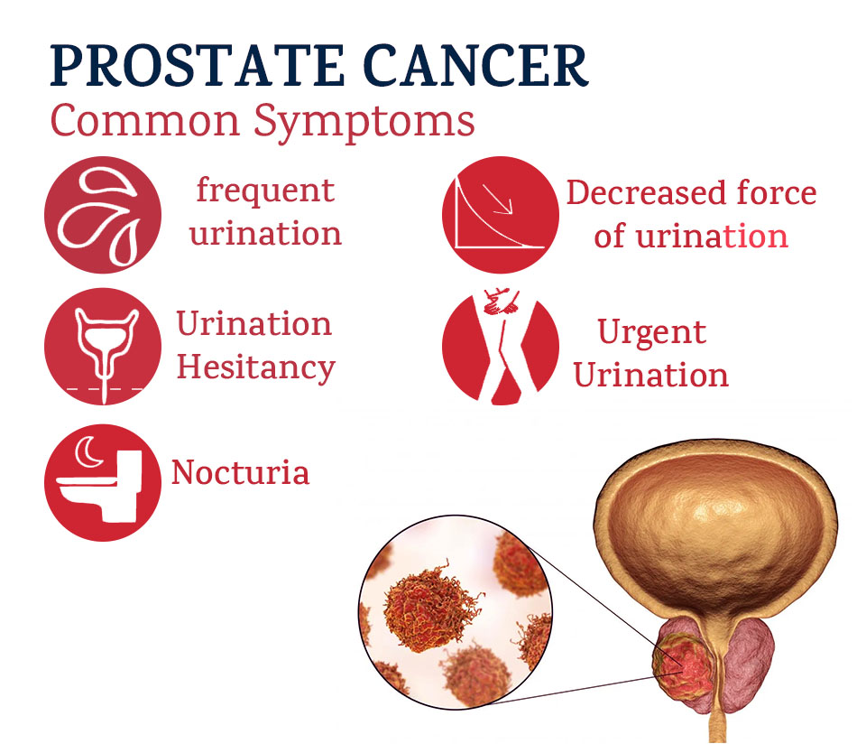 PROSTATE CANCER