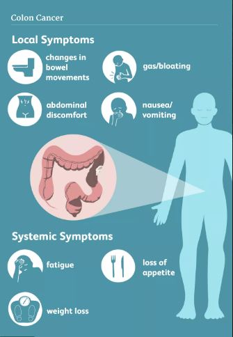 COLON CANCER