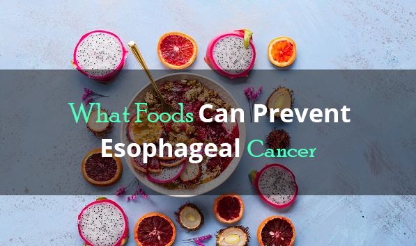 OESOPHAGAL CANCER