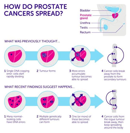 PROSTATE CANCER