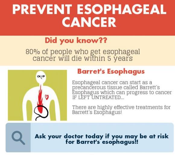 OESOPHAGAL CANCER