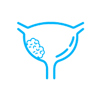 BLADDER CANCER