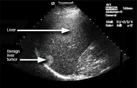 Ultrasonography(USG)